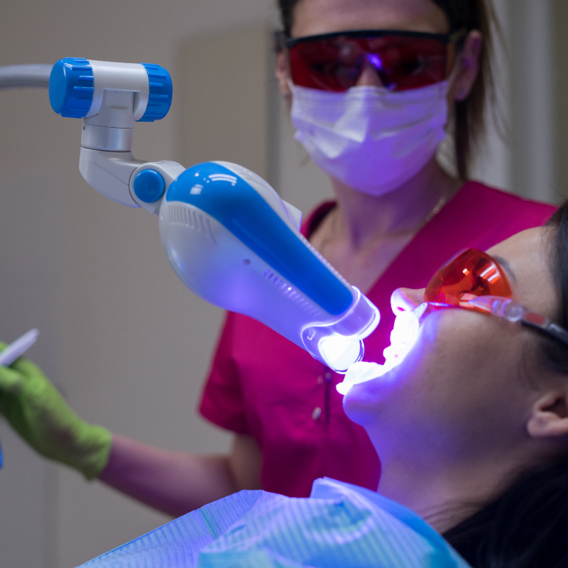 Kosmetische Zahnaufhellung Bleaching